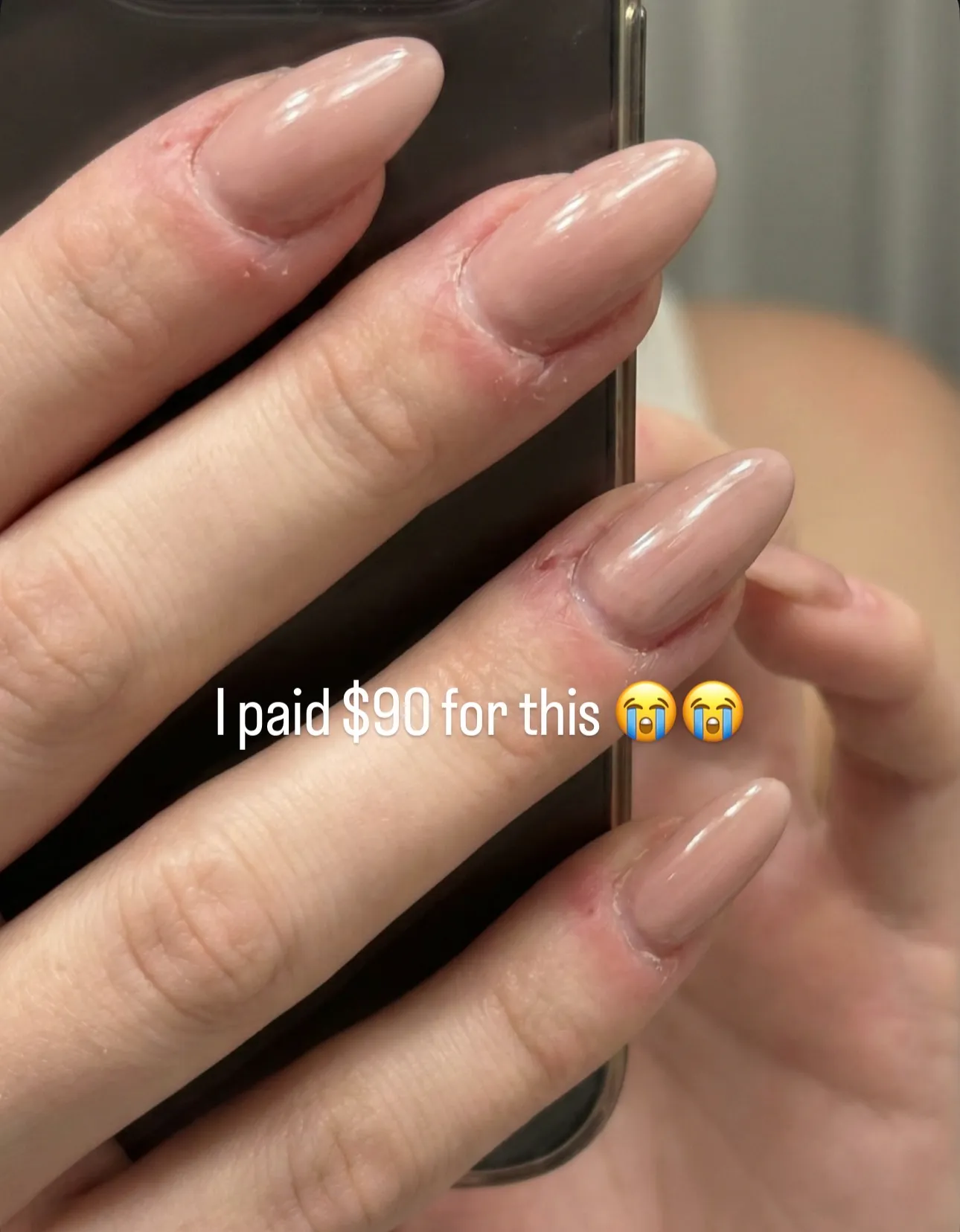 Before — damaged nails from salon